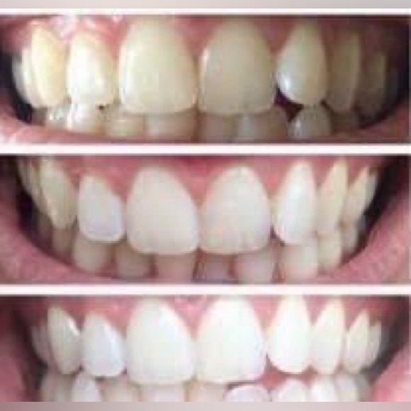 AP24 Whitening Toothpaste - Picture 5 of 7